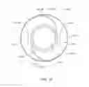 Fig. 37 - Prosthetic capsular devices, systems, and methods