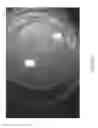 Fig. 55 - Prosthetic capsular devices, systems, and methods