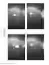 Fig. 56 - Prosthetic capsular devices, systems, and methods