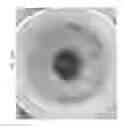 Fig. 60 - Prosthetic capsular devices, systems, and methods