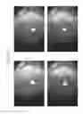 Fig. 63 - Prosthetic capsular devices, systems, and methods