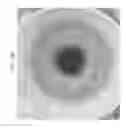 Fig. 75 - Prosthetic capsular devices, systems, and methods