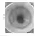 Fig. 80 - Prosthetic capsular devices, systems, and methods
