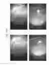 Fig. 84 - Prosthetic capsular devices, systems, and methods