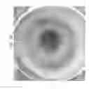 Fig. 85 - Prosthetic capsular devices, systems, and methods