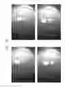 Fig. 89 - Prosthetic capsular devices, systems, and methods
