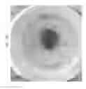 Fig. 90 - Prosthetic capsular devices, systems, and methods