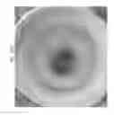 Fig. 95 - Prosthetic capsular devices, systems, and methods