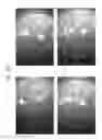 Fig. 99 - Prosthetic capsular devices, systems, and methods