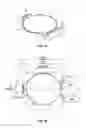 Fig. 05 - Modular intraocular lens designs, tools and methods