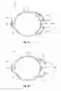 Fig. 07 - Modular intraocular lens designs, tools and methods