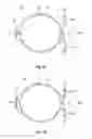 Fig. 08 - Modular intraocular lens designs, tools and methods