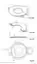 Fig. 10 - Modular intraocular lens designs, tools and methods