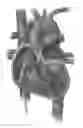 Fig. 01 - Platforms for mitral valve replacement