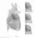 Fig. 04 - Platforms for mitral valve replacement