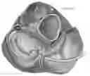 Fig. 07 - Platforms for mitral valve replacement