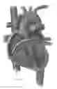 Fig. 09 - Platforms for mitral valve replacement