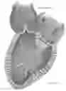 Fig. 16 - Platforms for mitral valve replacement
