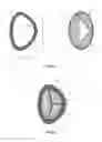 Fig. 06 - Cardiac valve prosthesis