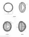 Fig. 07 - Cardiac valve prosthesis