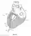 Fig. 08 - Cardiac treatment system and method