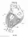 Fig. 09 - Cardiac treatment system and method
