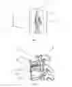 Fig. 02 - Prosthetic device