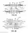 Fig. 05 - Expandable/variable lordotic angle vertebral implant and reading system therefor