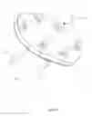 Fig. 11 - Artificial cervical and lumbar discs, disc plate insertion gun for performing sequential single plate intervertebral implantation enabling symmetric bi-disc plate alignment for interplate mobile core placement