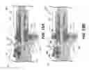 Fig. 13 - Intervertebral devices and related methods
