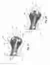 Fig. 17 - Intervertebral devices and related methods