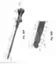 Fig. 20 - Intervertebral devices and related methods