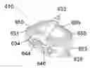 Fig. 01 - Implantable systems, devices and related methods