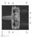 Fig. 10 - Implantable systems, devices and related methods