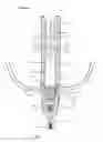 Fig. 01 - Hybrid compress bone fixator