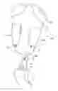 Fig. 01 - METHOD FOR PRODUCING A PROSTHESIS SHAFT, AND A PROSTHESIS SHAFT