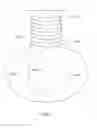 Fig. 05 - Graft anchor devices, systems and methods