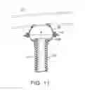 Fig. 11 - Graft anchor devices, systems and methods