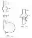 Fig. 14 - Graft anchor devices, systems and methods