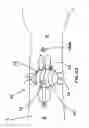 Fig. 08 - DEVICES AND METHODS FOR INCREASED BLOOD FLOW, HEALING, AND PAIN CONTROL