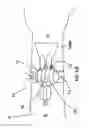 Fig. 09 - DEVICES AND METHODS FOR INCREASED BLOOD FLOW, HEALING, AND PAIN CONTROL