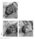 Fig. 02 - Proteasome modulation for treatment of corneal disorders