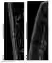 Fig. 03 - Proteasome modulation for treatment of corneal disorders