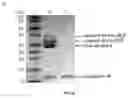 Fig. 04 - POLYMER CONJUGATES HAVING REDUCED ANTIGENICITY AND METHODS OF USING THE SAME