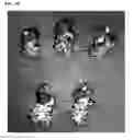 Fig. 06 - NANOPARTICLES FOR CANCER DETECTION