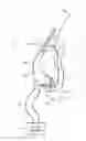 Fig. 01 - Customized mask with rigid support
