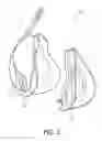 Fig. 03 - Customized mask with rigid support
