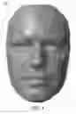 Fig. 05 - Customized mask with rigid support