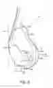 Fig. 07 - Customized mask with rigid support