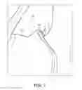 Fig. 08 - Customized mask with rigid support
